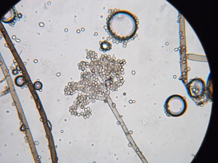 vista microscópica del hongo Botrytis cinerea
